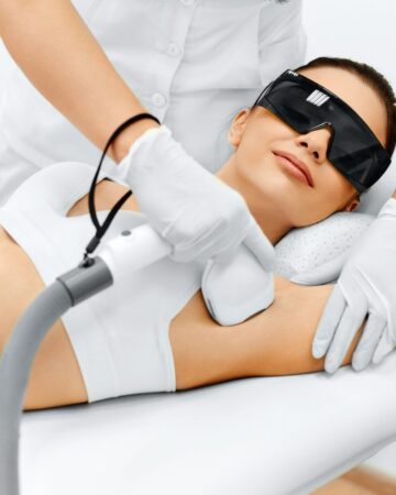 Lazer Epilasyon Nedir?